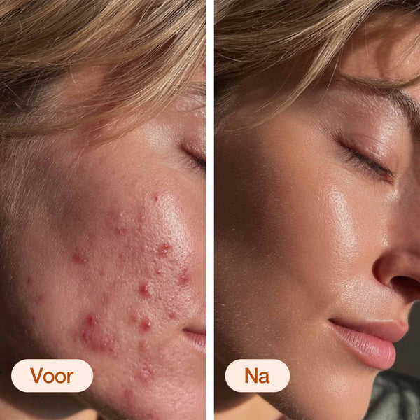 Anna is Clear 24/7 serum