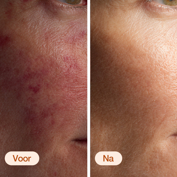 Anna is Clear 24/7 serum