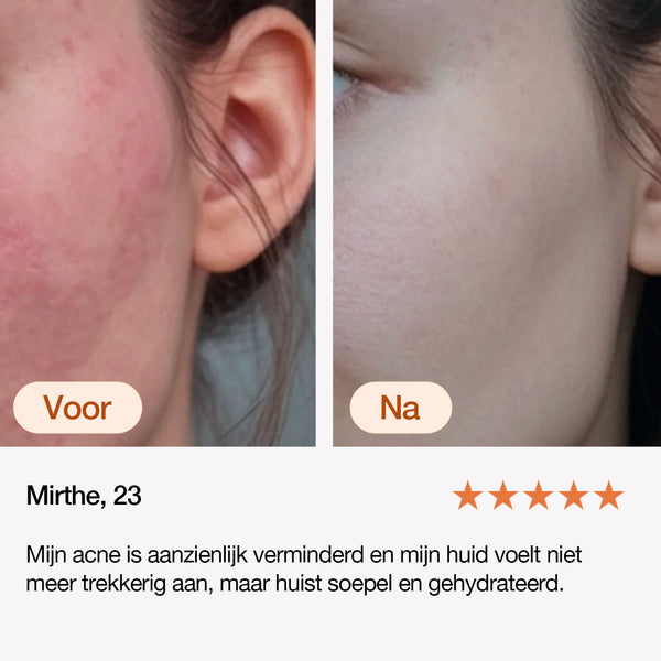 Anna is Clear 24/7 serum
