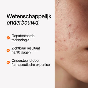 Anna is Clear 24/7 serum - Bundel